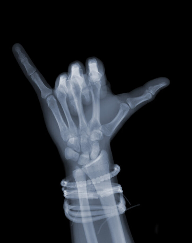 Hang Loose with Bands