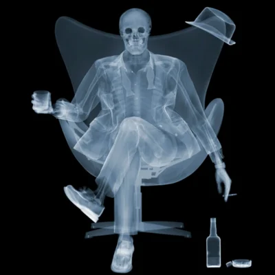 Xray Business Day